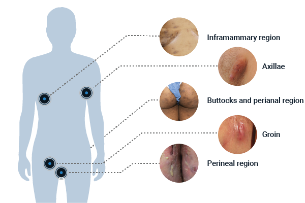 Commonly involved area image